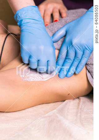 Waxing woman armpit. Salon wax beautician epilation procedure. Waxing female body for hair removal by therapist close up. Smooth underarm concept. Waxing woman armpit. Salon wax beautician epilation procedure. Waxing female body for hair removal by therapist close up. Smooth underarm concept. 64086503