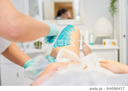 depilation and beauty concept -Beautician depilating young womans legs with liquid sugar in spa center. depilation of legs with turquoise shugaring paste 64096457