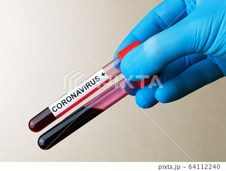 Hand in glove holds positive Coronavirus blood Hand in glove holds positive Coronavirus blood 64112240