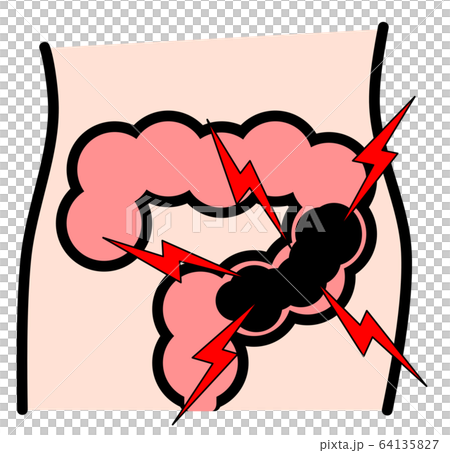 便秘 便秘 64135827