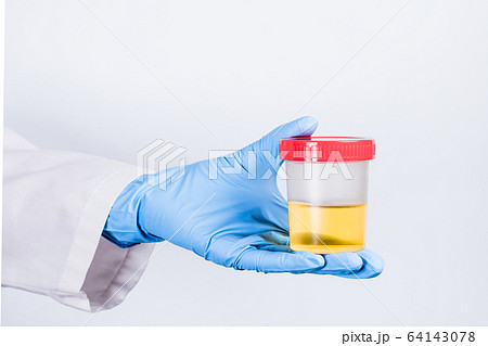 Close Up View To Test Tube with Urine and Blood Sticking Out from a Blue  Jeans Pocket Stock Photo - Image of equipment, medical: 149112006
