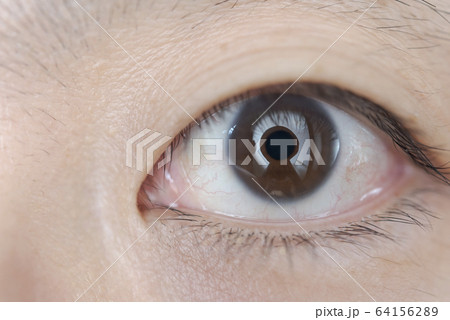 眼のアップ 64156289