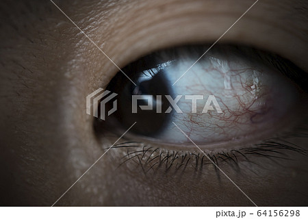 眼のアップ 64156298