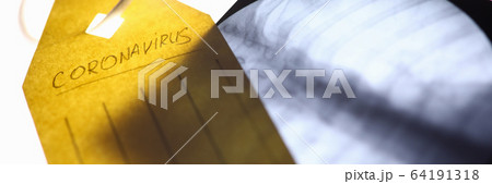 Photograph lung x-ray with tag from carrot 64191318