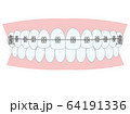 矯正装置 64191336