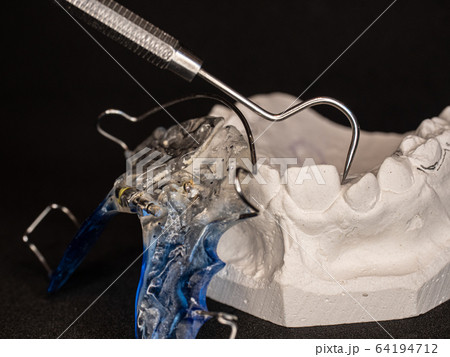 Temporary retainers on white plaster cast. 64194712