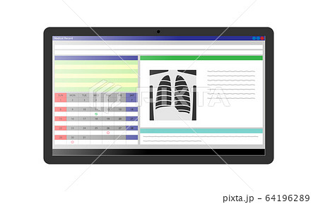 タブレット端末に表示された電子カルテのイラストのイラスト素材