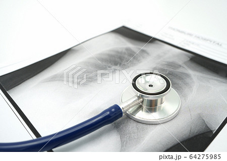 Lung x-ray To check for Covid 19 viruses or 64275985