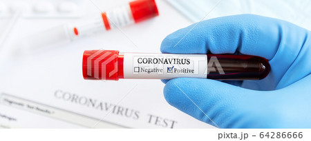 Panorama of Coronavirus blood test concept. 64286666