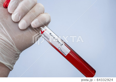 The virologist is holding a test tube with a blood sample infected with a coronovirus. Test for COVID-19 virus in the blood. Laboratory studies of bacteriological weapons. Pandemic SARS-CoV-2 64332924