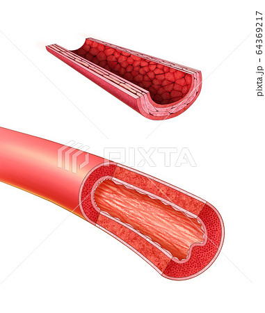 血管 医学 医療のイラスト素材