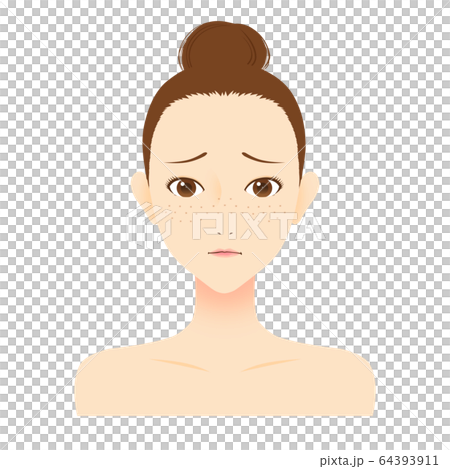 女性 肌トラブルに悩む そばかす 女性 肌トラブルに悩む そばかす 64393911