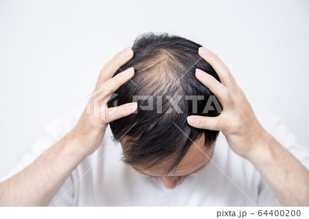 薄毛に悩む中年男性 64400200