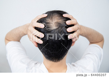 薄毛に悩む中年男性 64400207