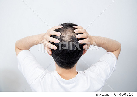 薄毛に悩む中年男性 64400210