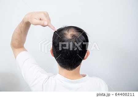 薄毛に悩む中年男性 64400211
