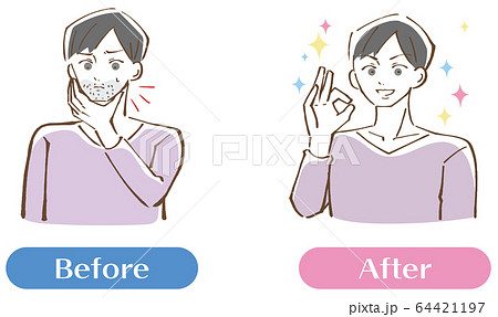 青髭が生えている男性ビフォーアフターセット イラストのイラスト素材