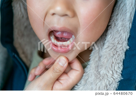 6 years old 6 years old 64480670