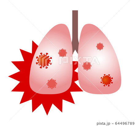 肺とウイルス 64496789
