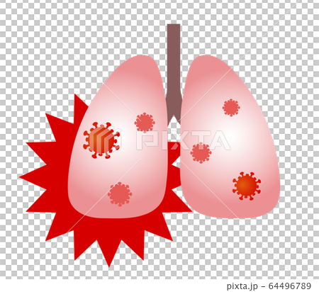 肺とウイルス 64496789