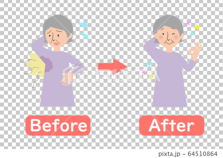 脇汗に悩むおばあちゃんのビフォーアフターのベクターイラスト 64510864