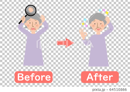 頭の薄毛に悩むおばあちゃんのビフォーアフターベクターイラスト 64510866