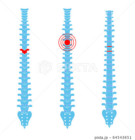 Human spine pain vector illustration 64543651