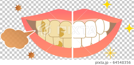 口臭和美白 64548356