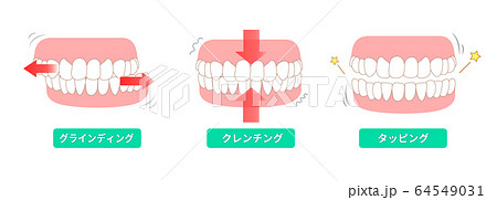 歯ぎしりの種類 クラインディング クレンチング タッピング 歯ぎしりの種類 クラインディング クレンチング タッピング 64549031