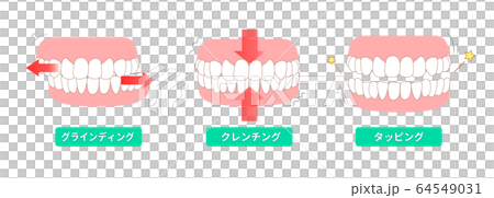 歯ぎしりの種類 クラインディング クレンチング タッピング 歯ぎしりの種類 クラインディング クレンチング タッピング 64549031