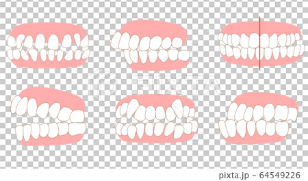 需要治療的牙列清單：擁擠，對側咬合，咬合，上頜前突，蛀牙，牙列