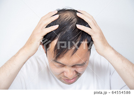 薄毛に悩む中年男性 薄毛に悩む中年男性 64554586