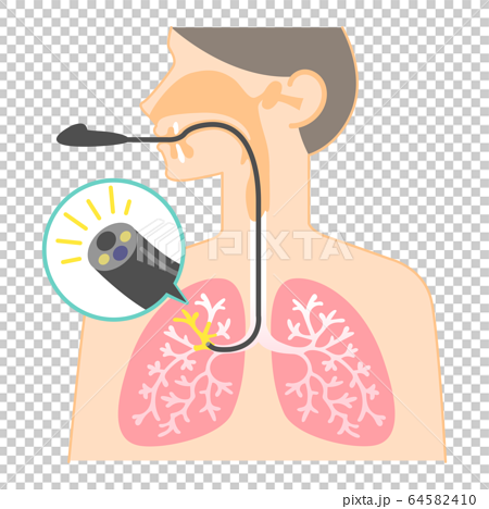 気管支鏡検査のイラスト 図表 説明図 肺カメラ のイラスト素材
