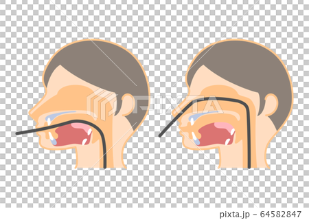経口内視鏡と経鼻内視鏡のイラスト(胃カメラの挿入・文字なし) 経口内視鏡と経鼻内視鏡のイラスト(胃カメラの挿入・文字なし) 64582847