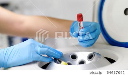 Lab man puts in centrifuge tube with blood for testing coronavirus Lab man puts in centrifuge tube with blood for testing coronavirus 64617042