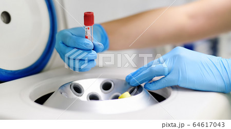 Lab man puts in centrifuge tube with blood for  testing coronavirus 64617043