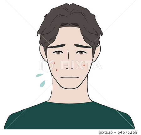 にきび肌に悩む男性 64675268