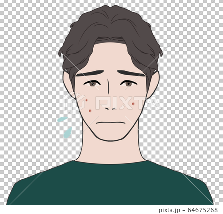 にきび肌に悩む男性 64675268