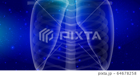 肺　レントゲン　人体　背景 64678258