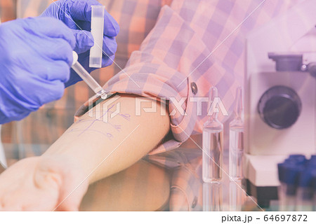 Allergy tests in laboratory 64697872