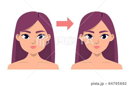 Face contour plastic surgery vector isolated 64795692