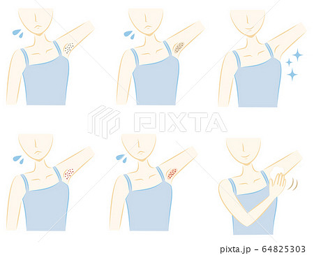 女性の脇の肌トラブル 黒ずみ 赤み 色素沈着 埋没毛 脱毛のイラスト素材
