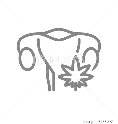 Woman uterus with marijuana leaf line icon. Cannabis treatment, anesthesia symbol 64850971