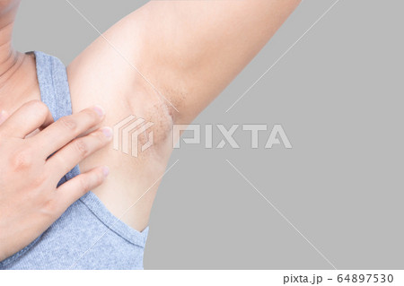 Women problem black armpit with grey background 64897530