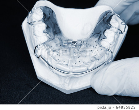 Orthodontic removable retainer. Dental braces Orthodontic removable retainer. Dental braces 64955925