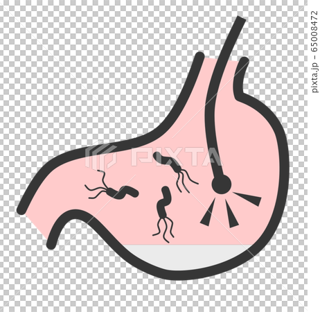 胃カメラのイラスト素材