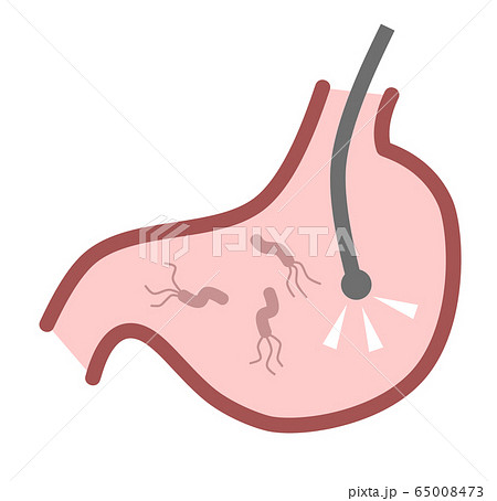 胃カメラのイラスト素材