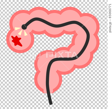 大腸カメラ 65008771