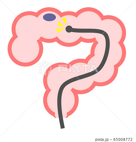 大腸カメラ 65008772