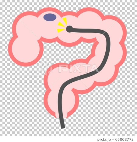 大腸カメラ 65008772